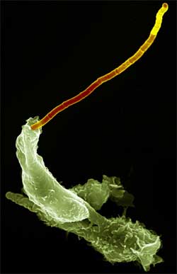 Нейтрофил поглощает бациллу сибирской язвы